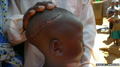 Ni�o mutilado en Uganda. �BBC