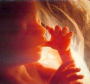 ABORTO