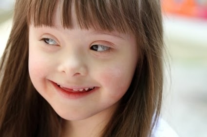 99% de los s�ndrome de Down son felices con sus vidas, el 90% son abortados