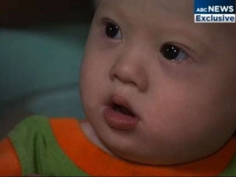 Maternidad subrogada: tienen mellizos y abandonan uno por �defectuoso�